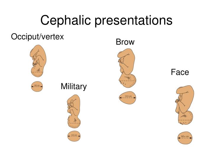 military presentation of fetus