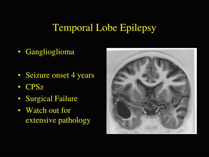 temporal lobe epilepsy Complex partial-onset seizure often, these begin as simple seizures in a part of the brain known as the temporal or frontal lobe complex. temporal lobe epilepsy Complex partial-onset seizure often, these begin as simple seizures in a part of the brain known as the temporal or frontal lobe complex.