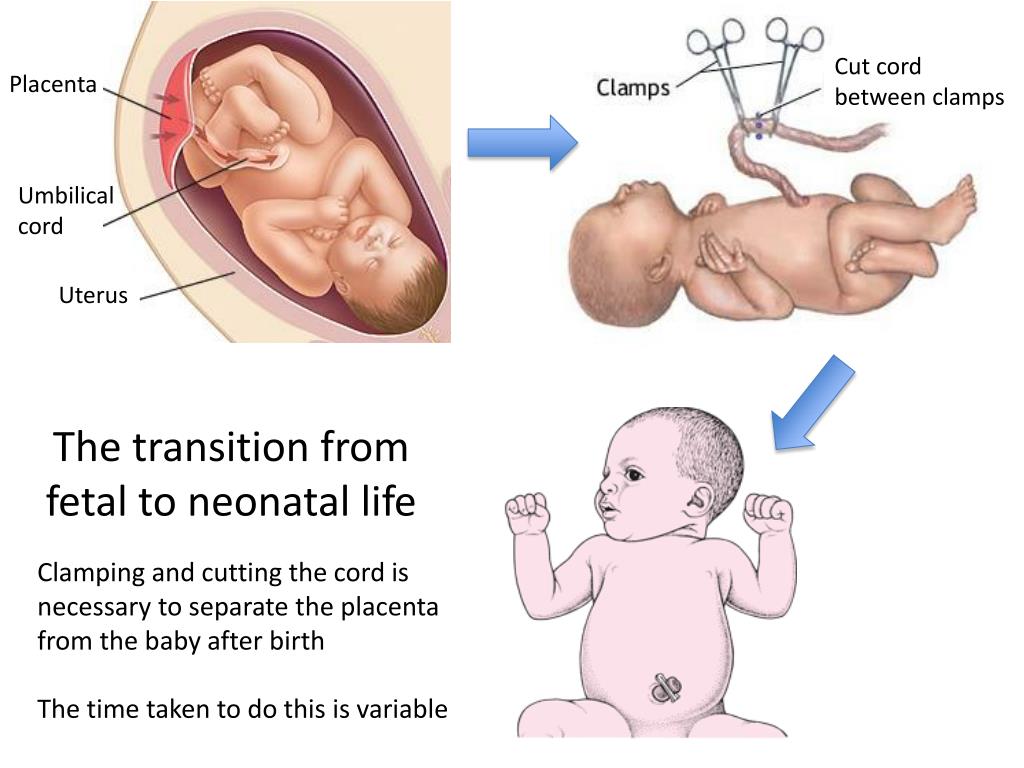 umbilical cord and placenta difference between caucus