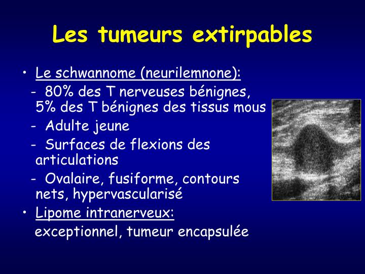 PPT - Tumeurs Pseudo-tumeurs des parties molles PowerPoint Presentation ...