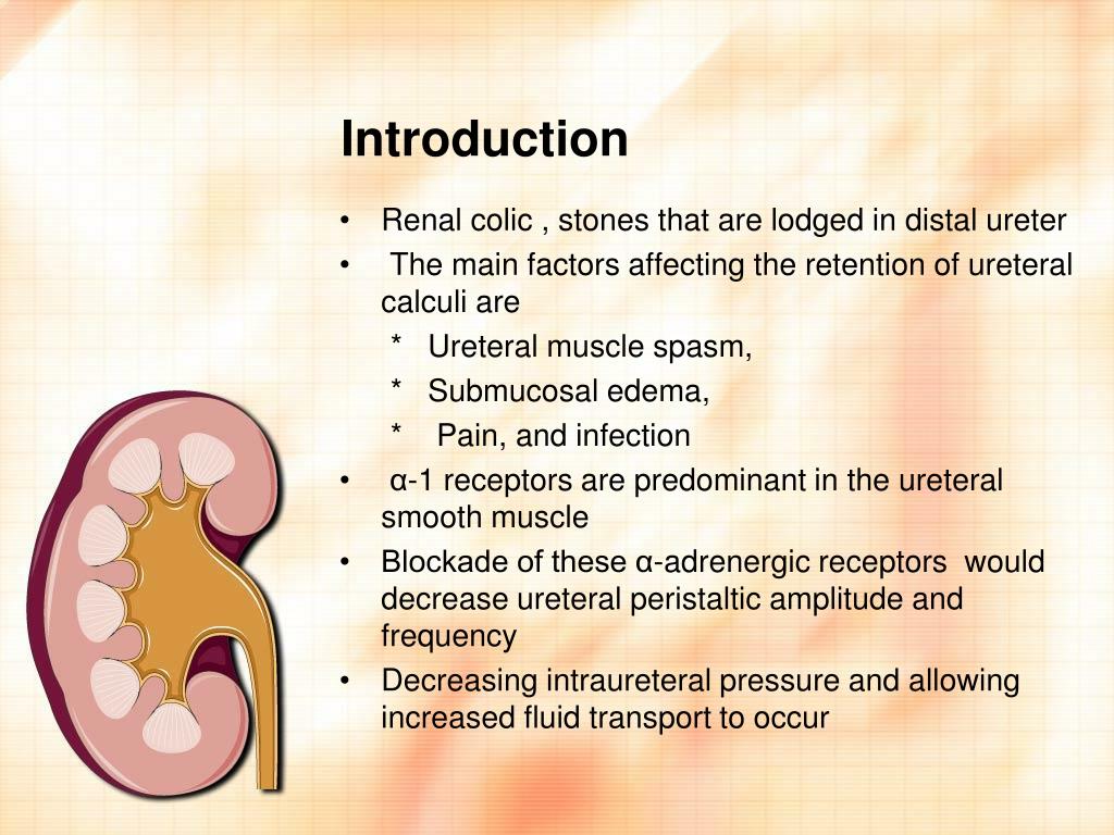 PPT - Tamsulosin for Ureteral Stones in the Emergency Department: A ...