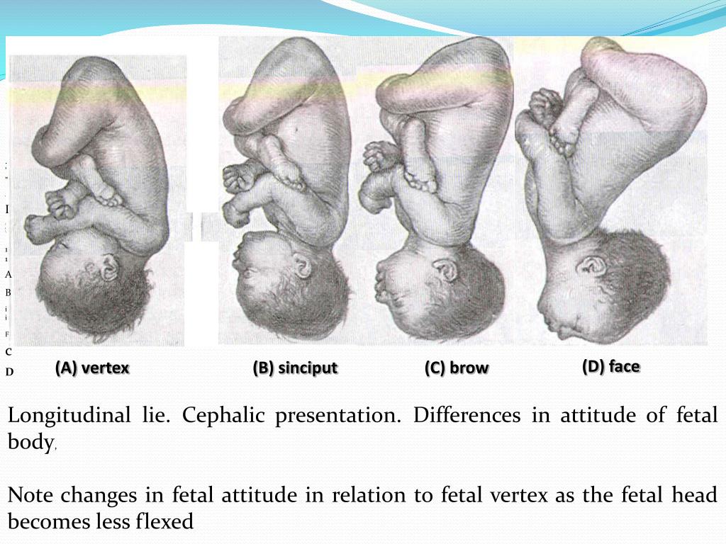 face presentation mechanism of labour