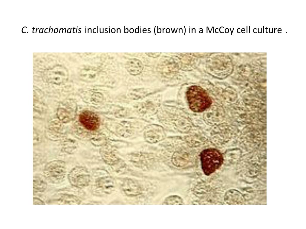 Хламидия trachomatis. Chlamydia trachomatis под микроскопом.