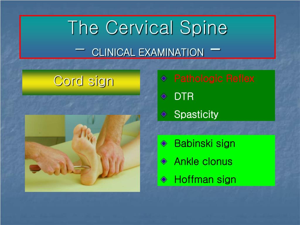 Ppt The Cervical Spine Powerpoint Presentation Free Download Id Ppt The Cervical Spine Powerpoint Presentation Free Download Id