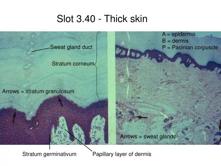 slide1 n.