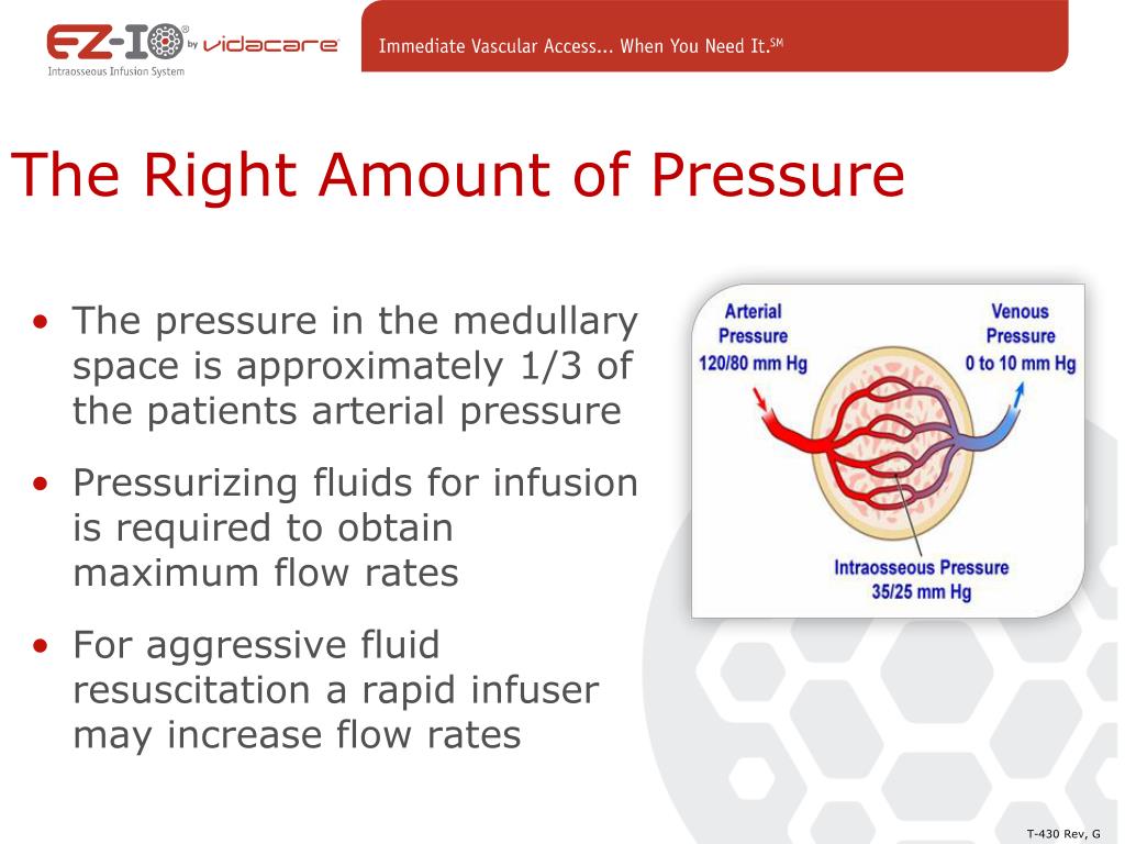 PPT - The 5 Rights Of Intraosseous Vascular Access PowerPoint ...