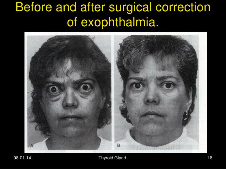 PPT - Thyroid Hormone. PowerPoint Presentation - ID:4827181