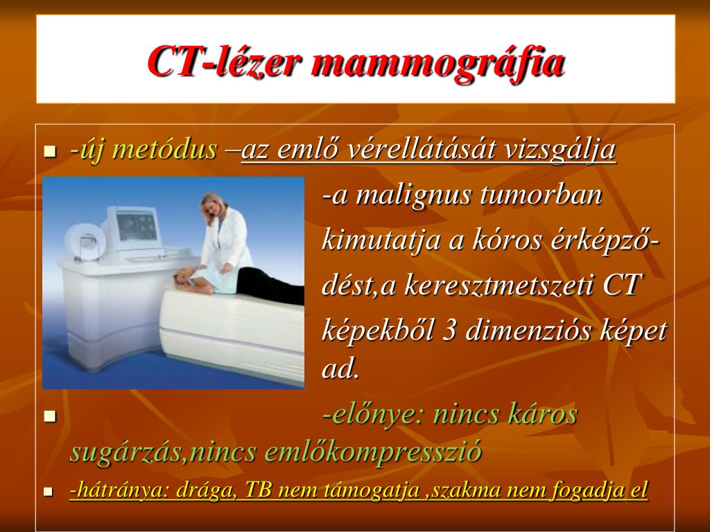 PPT - Emlőszűrés és klinikai mammográfia PÉCS-KEN -2011.06.10-13. dr. Bozó  Zsuzsanna PowerPoint Presentation - ID:4833153