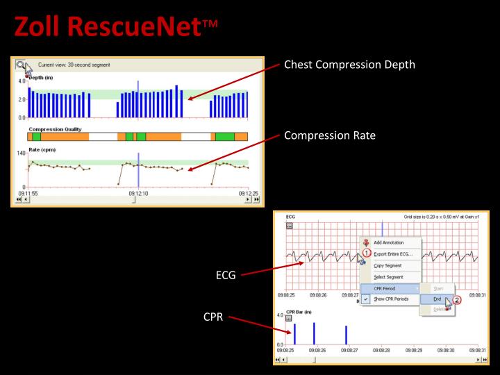 Chest Compression Fraction Charthrom chest-compression-fraction-charthrom