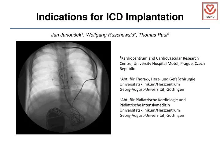 PPT - Indications for ICD Implantation PowerPoint Presentation, free ...