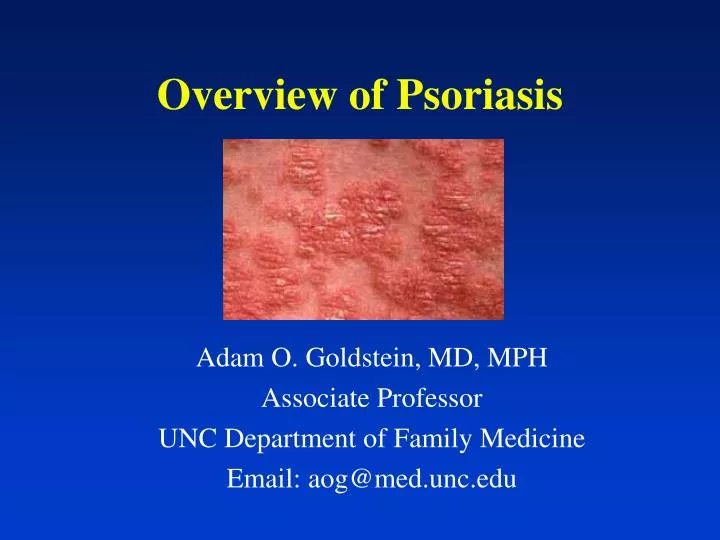 overview of psoriasis n.