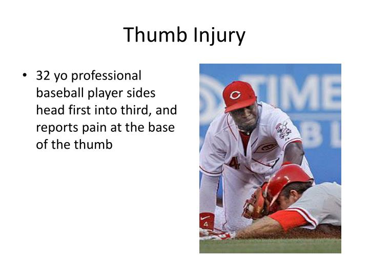 PPT SportsRelated Hand and Wrist Injuries PowerPoint Presentation