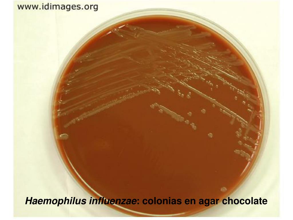 Haemophilus influenzae 10. Бактерии Haemophilus influenzae. Гемофильная палочка микробиология. Геном бактерии Haemophilus influenzae.