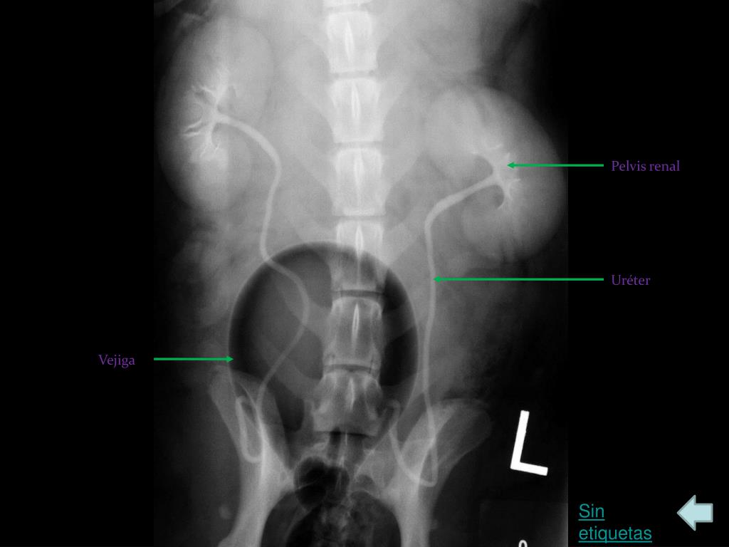 PPT - Radiología del Perro: abdomen y cavidad pelviana PowerPoint ...