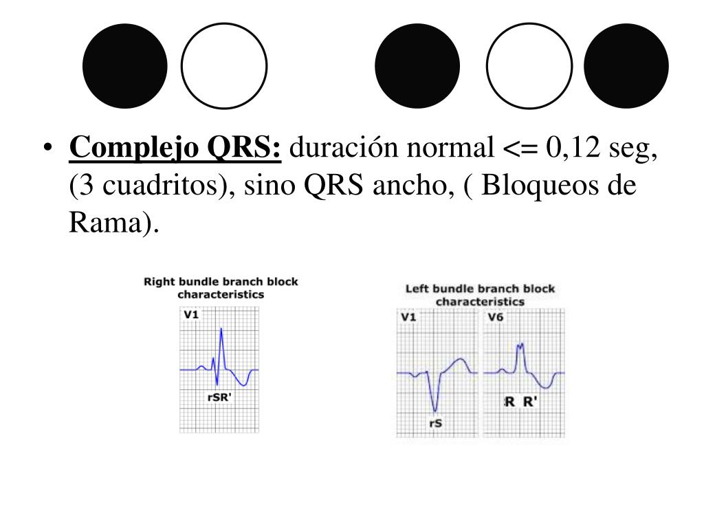 PPT Lectura B sica Electrocardiograma PowerPoint Presentation Free