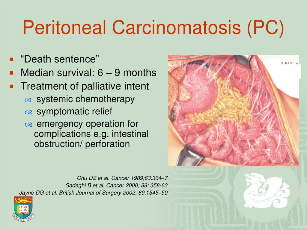 PPT Management of Peritoneal Carcinomatosis in Colorectal Cancer