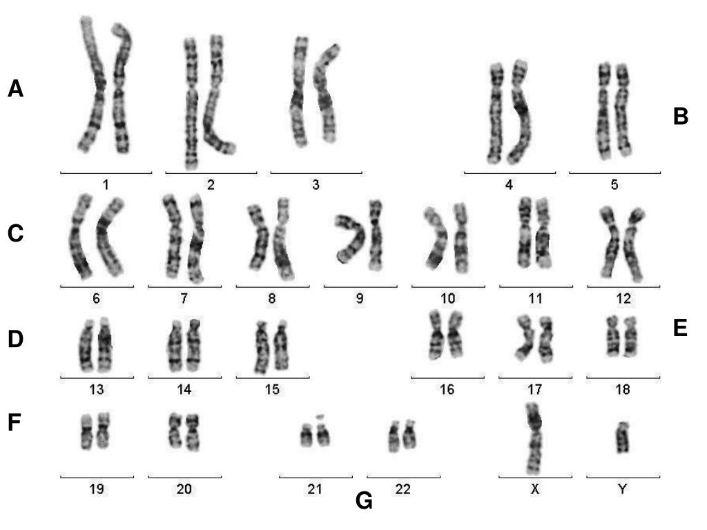 Х хромосома это мужская. 46 XY хромосомы. Хромосомы человека XY. XY хромосомы пол. XX XY хромосомы.