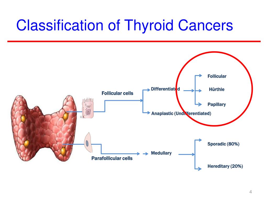 Stages Of Thyroid Cancer