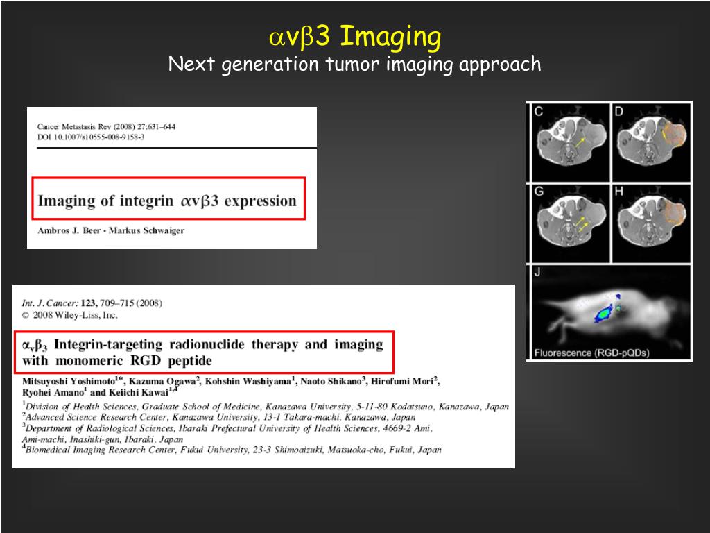 PPT - NOVEL ASSOCIATION BETWEEN THYROID HORMONES and MYELOMA CELL ...