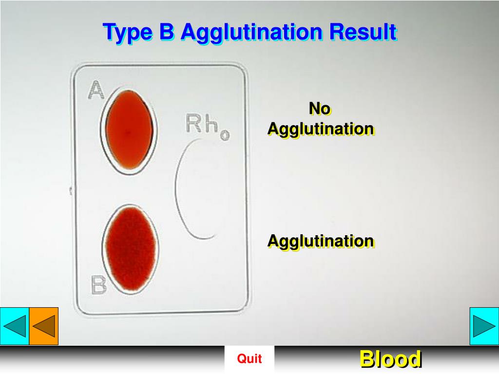 PPT - Blood PowerPoint Presentation, Free Download - ID:4857975