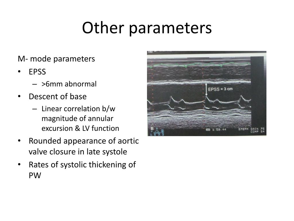PPT - Assessment of LV Systolic Function PowerPoint Presentation, free download - ID:4858150