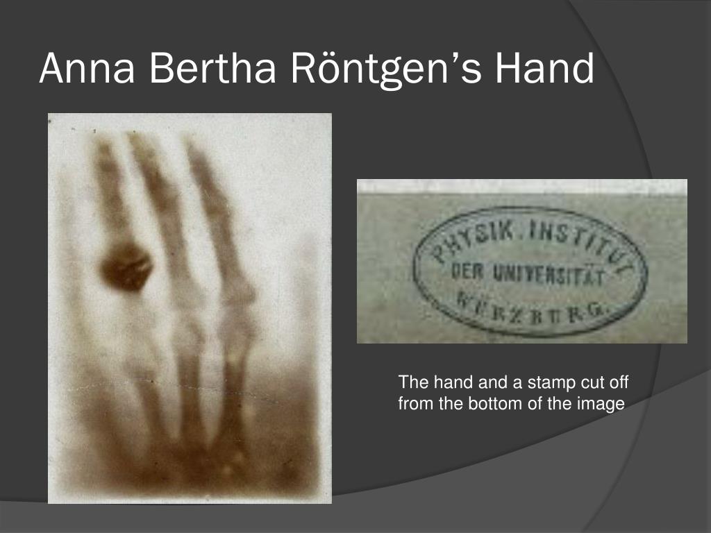 PPT - Wilhelm Röntgen and the X-ray PowerPoint Presentation, free download - ID:4865471