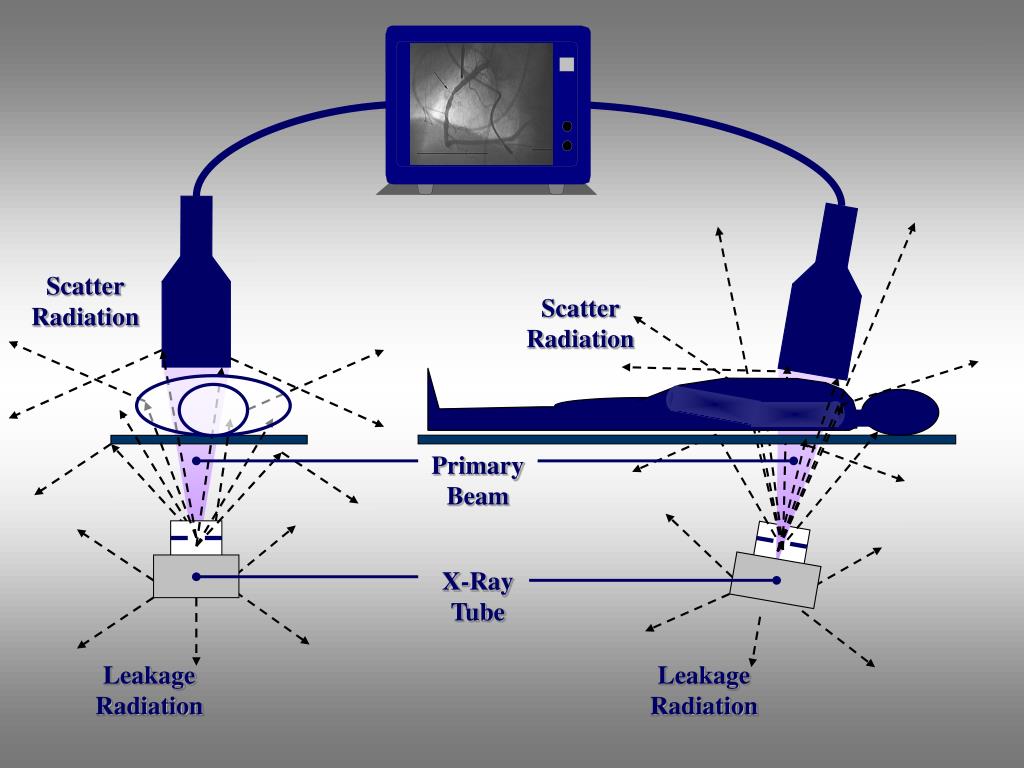 scatter radiation scatter radiation
