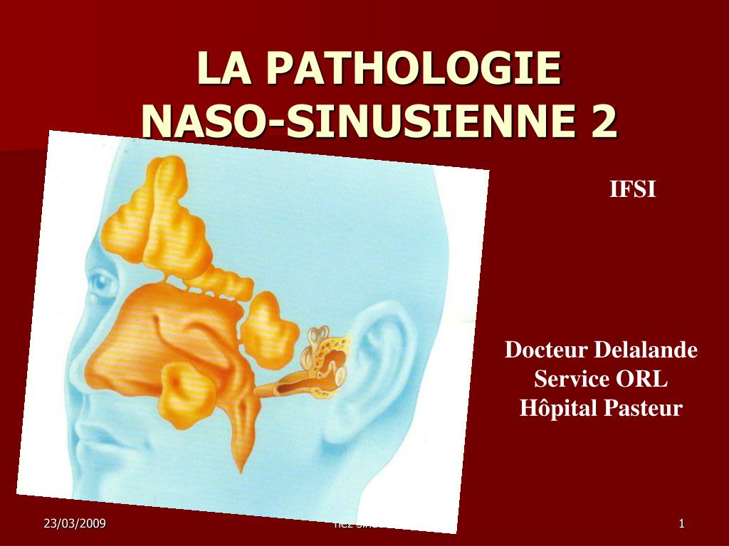 PPT - LA PATHOLOGIE NASO-SINUSIENNE 2 PowerPoint Presentation, free  download - ID:4867324
