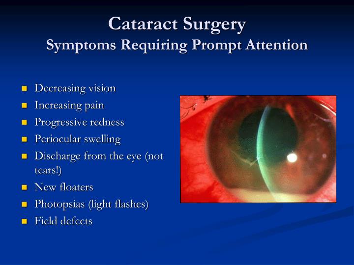 what are possible complications <a href="https://digitales.com.au/blog/wp-content/review/antibiotics/cefdinir-300-mg-price-philippines.php">click to see more</a> cataract surgery