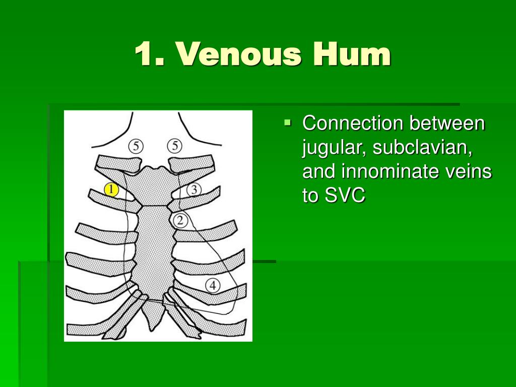 Venous Hum by Suzette Mayr Venous Hum by Suzette Mayr