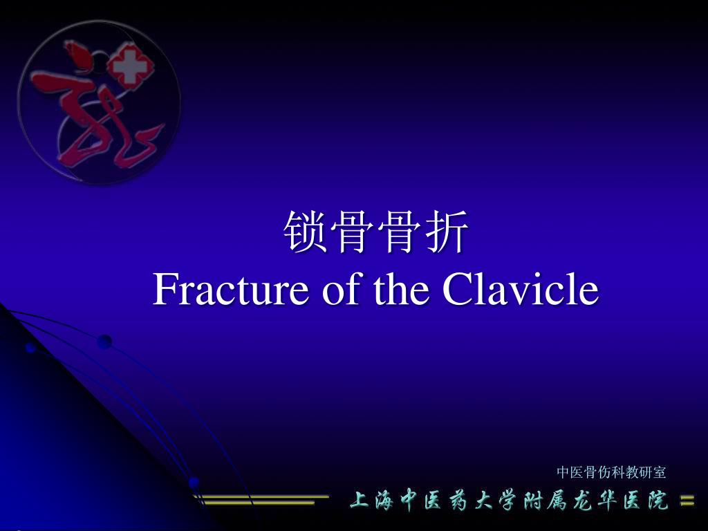 Ppt 锁骨骨折fracture Of The Clavicle Powerpoint Presentation Free Download Id