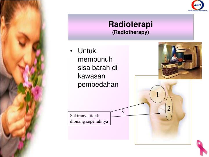 PPT - Kanser Payu Dara (Breast Cancer) PowerPoint 