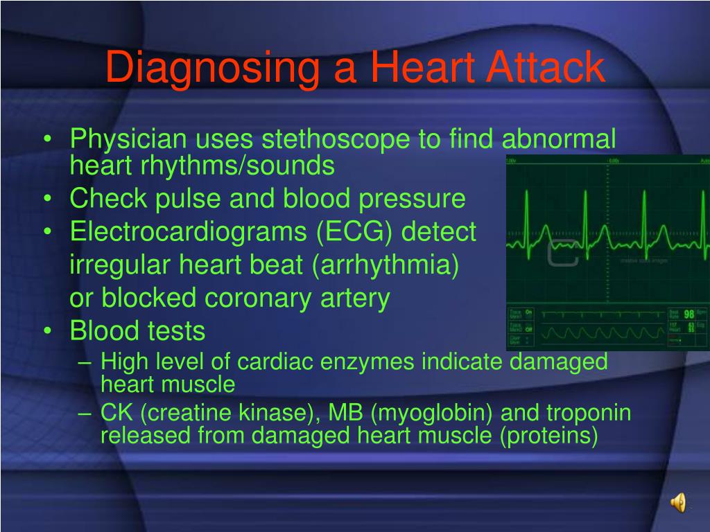 presentation of heart attack