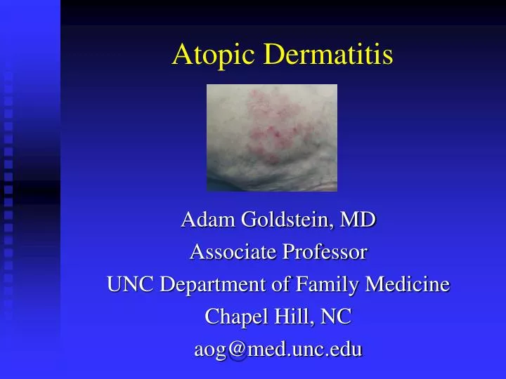 case study a rash of rashes case study a rash of rashes