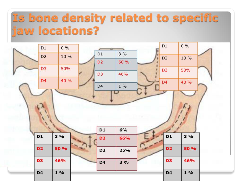 PPT - IMPLANTOLOGY QUESTIONS &amp; ANSWERS PowerPoint Presentation -  ID:4934914