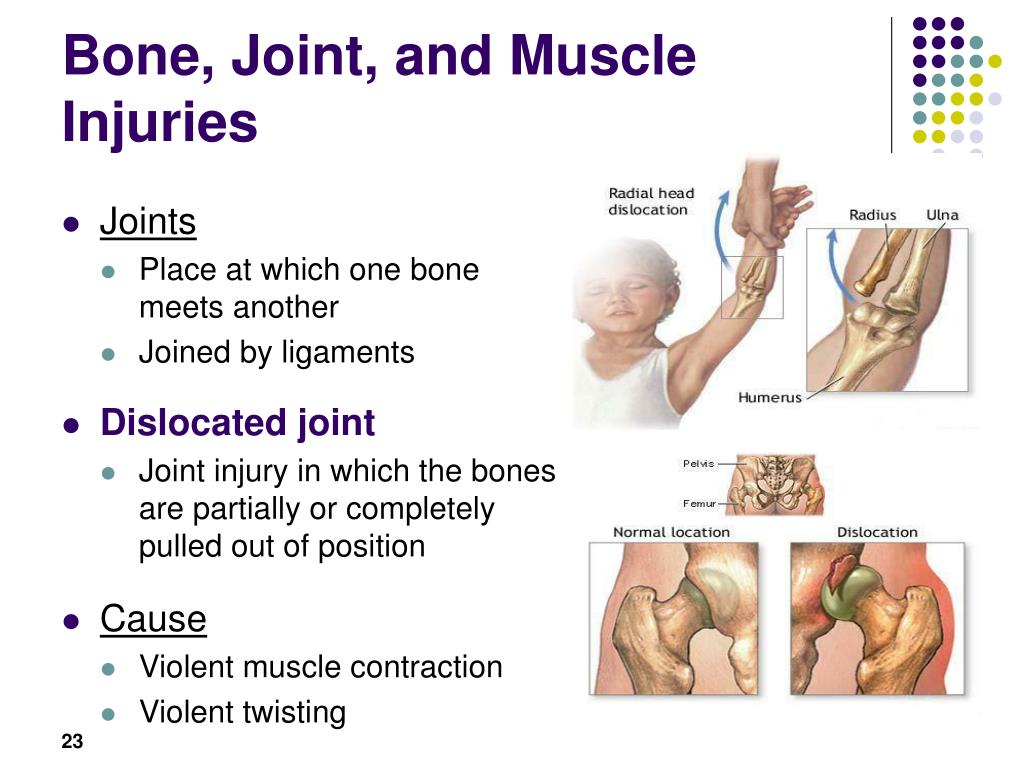 Bones and muscles. Bone Joint muscle injuries. Bones and Joints Tubereuses. Critical Industrial injuries презентация.