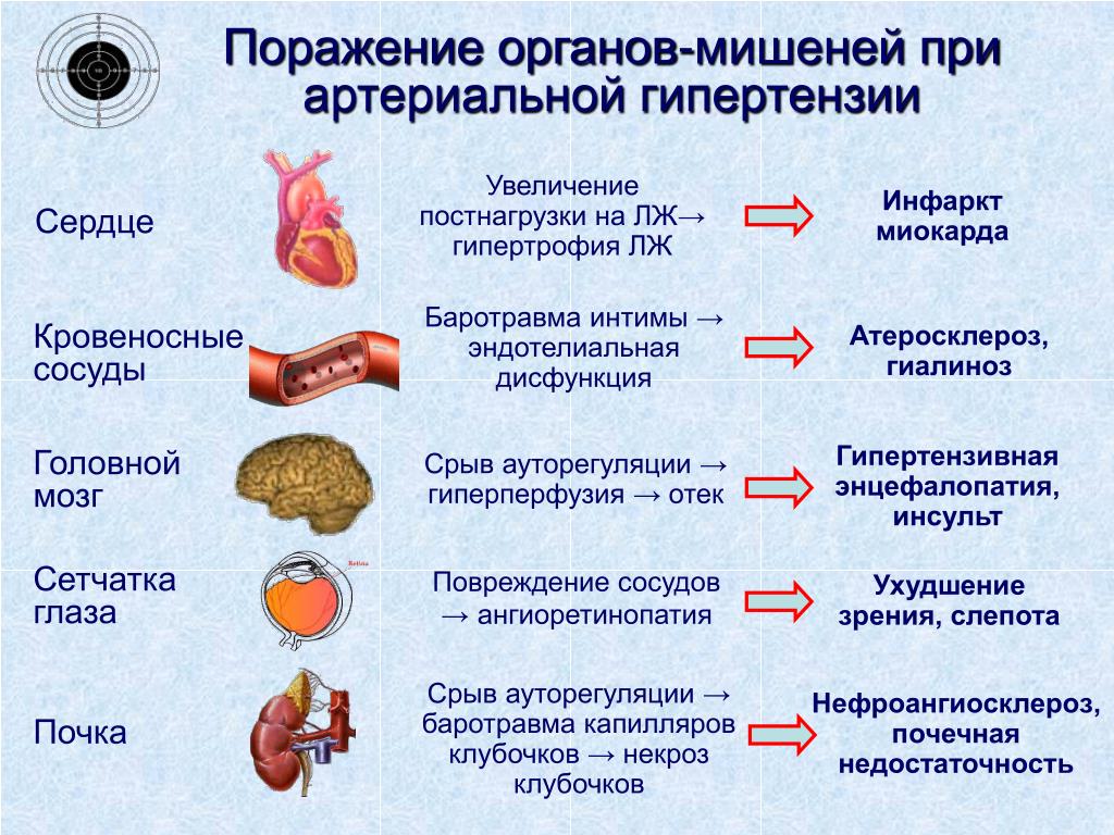 У сердца есть мозг. Гипертоническая болезнь поражение органов мишеней. Поражение органов мишеней при артериальной гипертензии. Стадии гипертонической болезни поражение органов мишеней. Органы-мишени, поражающиеся при гипертонической болезни.