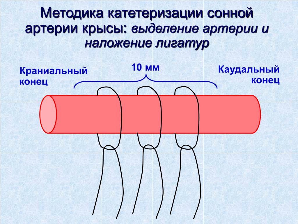 В конце концов выделяется. Методика наложения лигатур на артерию. Экспериментальное моделирование артериальных гипертензий. Наложение лигатуры на сосуд фото.