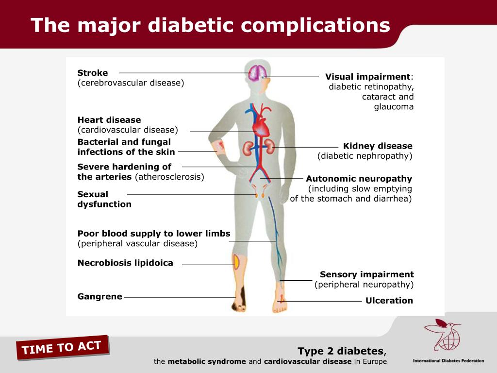 PPT - Type 2 diabetes, the metabolic syndrome and cardiovascular