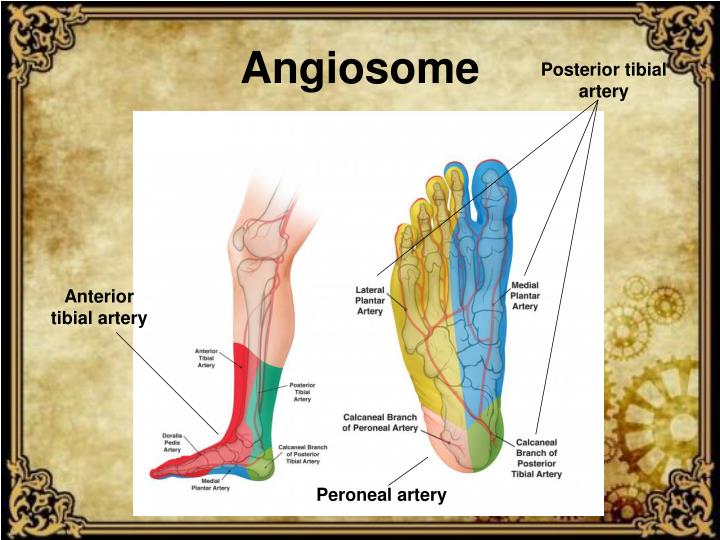 PPT - Management of distal peripheral vascular disease PowerPoint ...