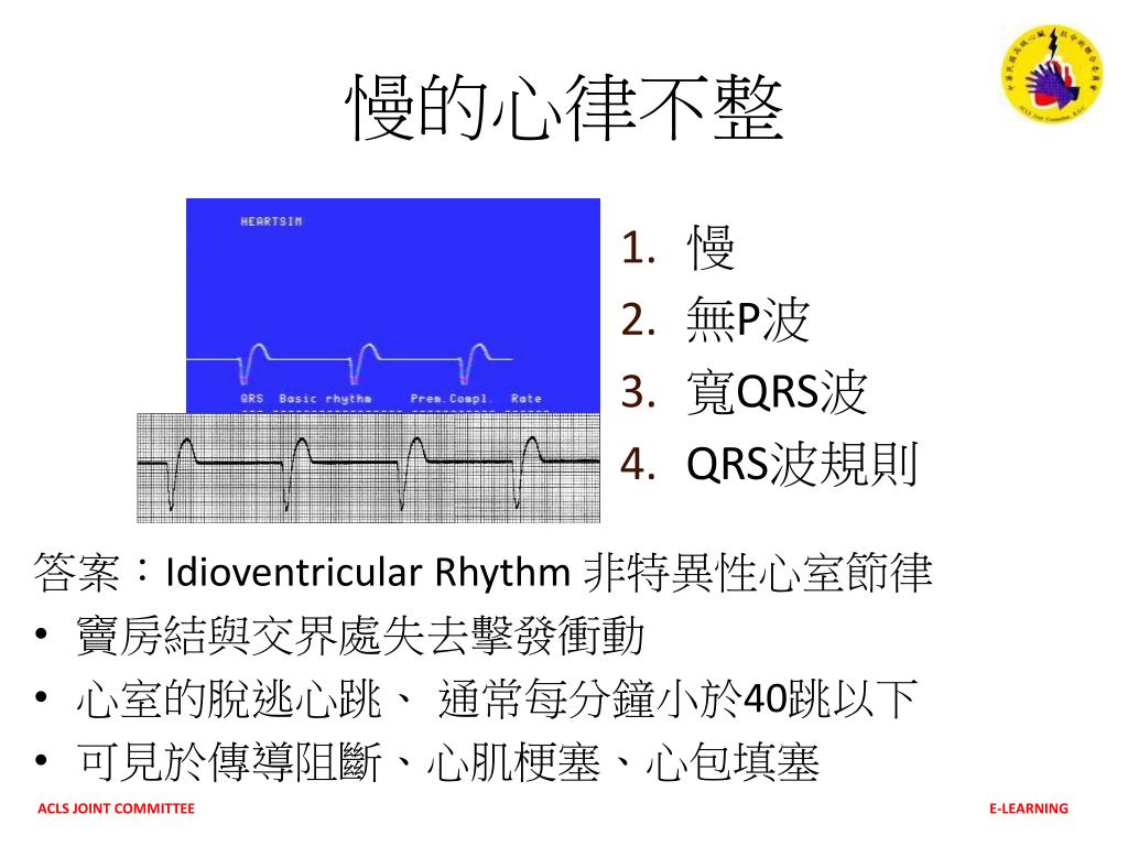 Ppt 動態心律不整判讀dysrhythmias Powerpoint Presentation Free Download Id Ppt 動態心律不整判讀dysrhythmias Powerpoint Presentation Free Download Id