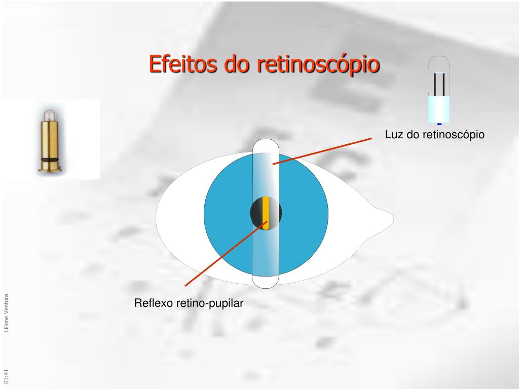 PPT Princípio s da Retinoscopia e Função de Correção dos Vícios de
