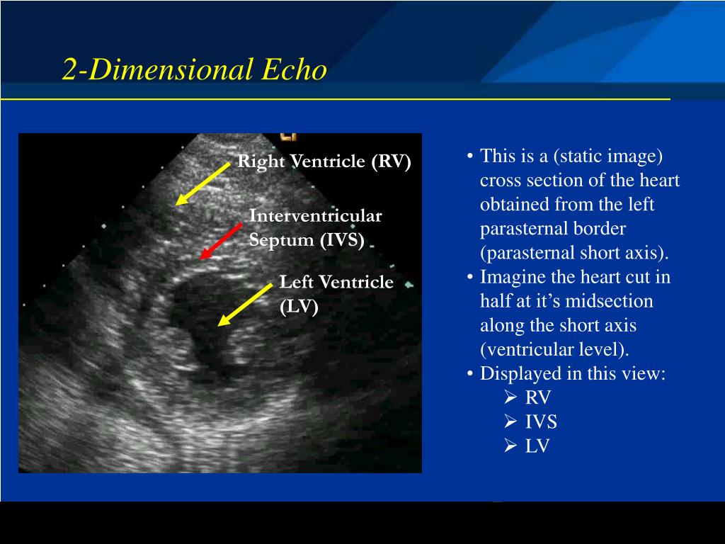 PPT - Basic Echocardiography Modes and Modalities PowerPoint Presentation -  ID:4979095