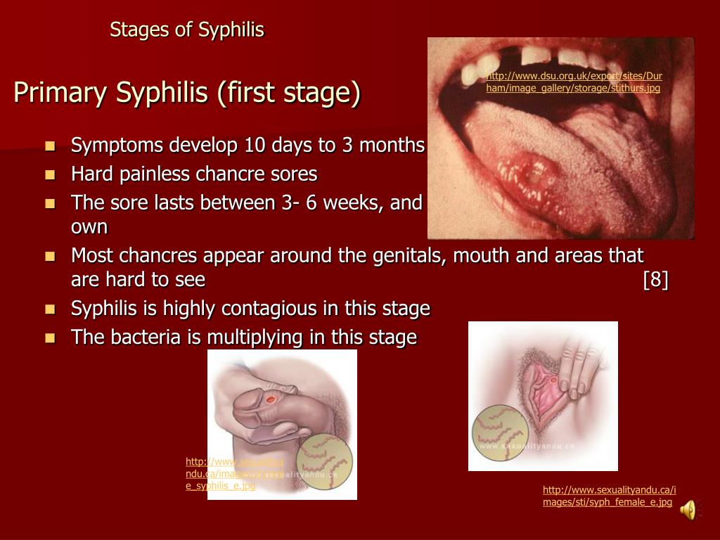 PPT - Syphilis PowerPoint Presentation - ID:49791961024 x 768