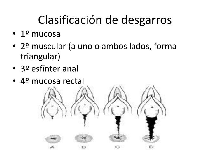 PPT - Episiotomia y desgarro perineal PowerPoint Presentation - ID:4979747