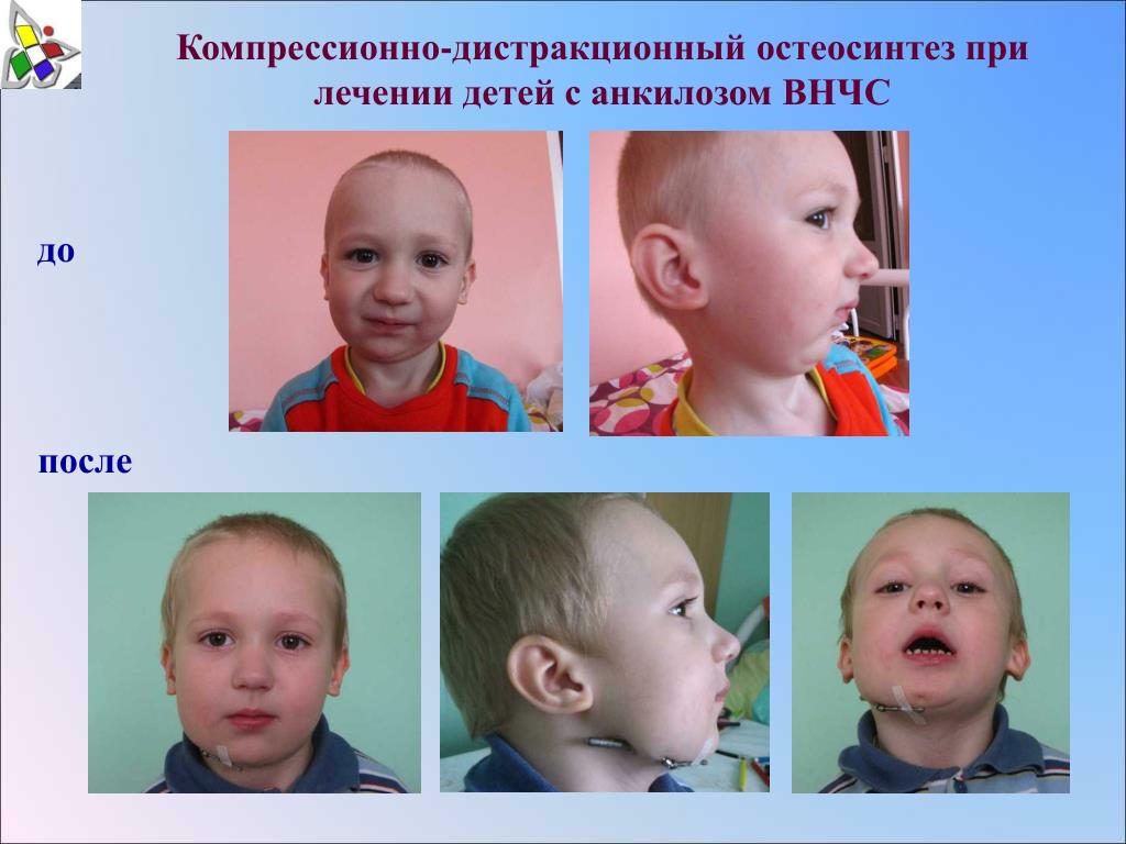 Челюстно лицевая Челюстно лицевая
