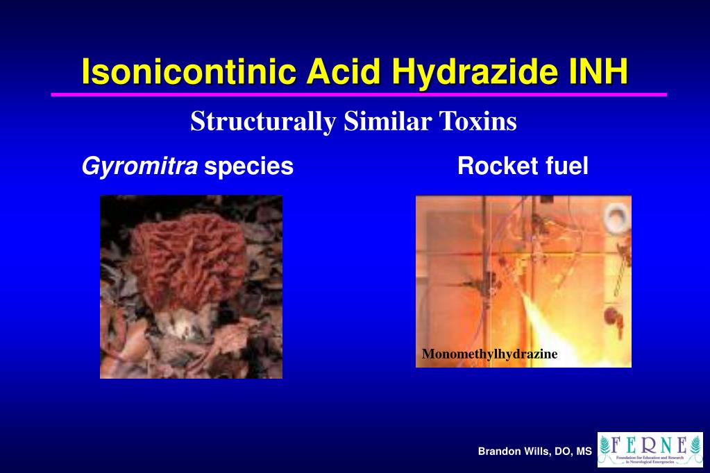 PPT - Management of Isoniazid Toxicity in a 23-Year-Old Woman ...