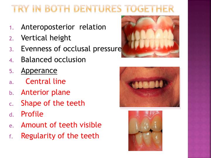 Ppt Try In Of Complete Dentures Powerpoint Presentation Id4997759 7367