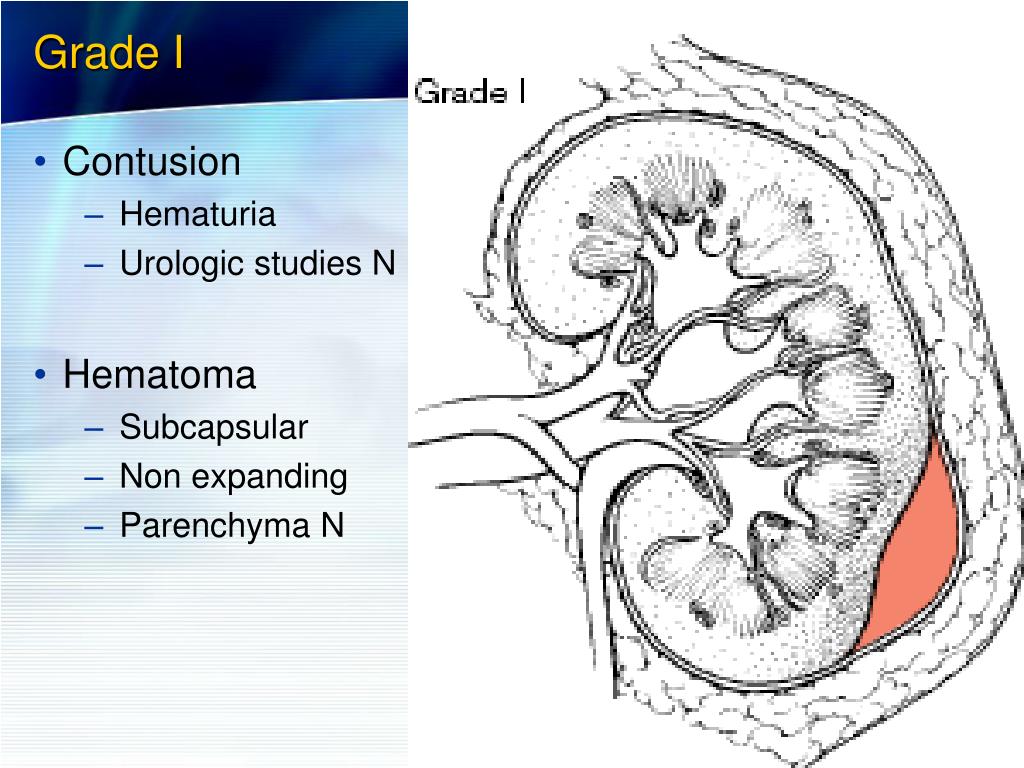 PPT Renal Trauma PowerPoint Presentation Free Download ID 4999497 PPT Renal Trauma PowerPoint Presentation Free Download ID 4999497