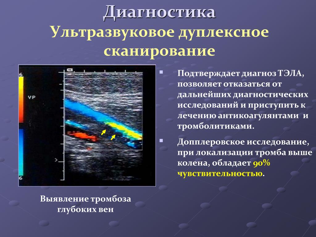 Доплер вредно. Ультразвуковая допплерография сосудов. Ультразвуковая допплерография артерий нижних конечностей. Ультразвуковое дуплексное ангиосканирование. Допплеровское исследование сосудов конечностей.